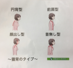 寝違え 宮前まちの整骨院 神奈川県川崎市宮前区宮前平 田園都市線 宮前平 駅より徒歩6分 腰痛 肩こり 猫背矯正